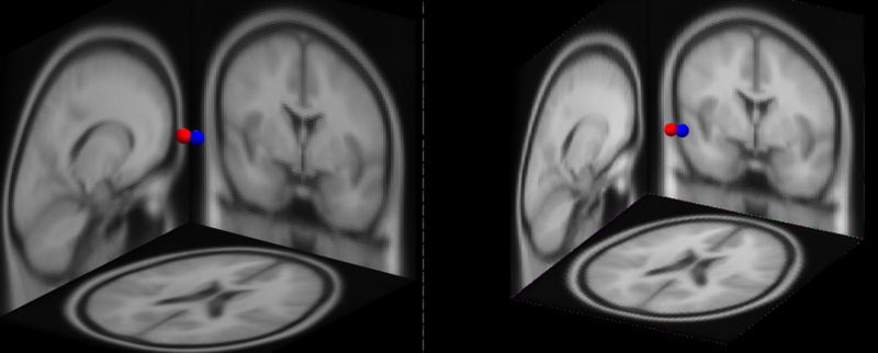 マットラボとOctaveのダイポール