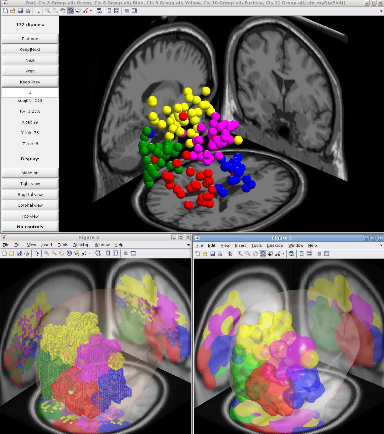 Dipfitcomparison.png - 株式会社ドリテック
